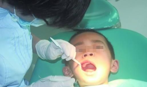 牙痛|6岁的孩子牙痛不见了，他被送到医院检查后，医生责备他的父母无知