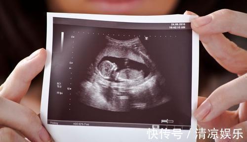 爱尔兰医院|生儿子有哪些坑？孕妈：还没出生，儿子的坑妈模式就已经开始了！