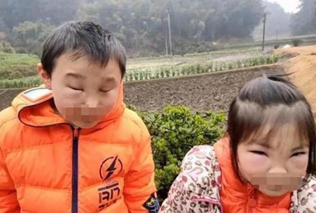 孩子|兄妹俩无意捅马蜂窝,瞬间变成“猪头”,宝妈气炸:是不是欠收拾