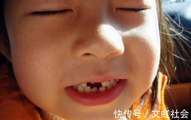 牙齿|最全儿童换牙时间表：儿童换牙何时开始、何时结束？一图说清