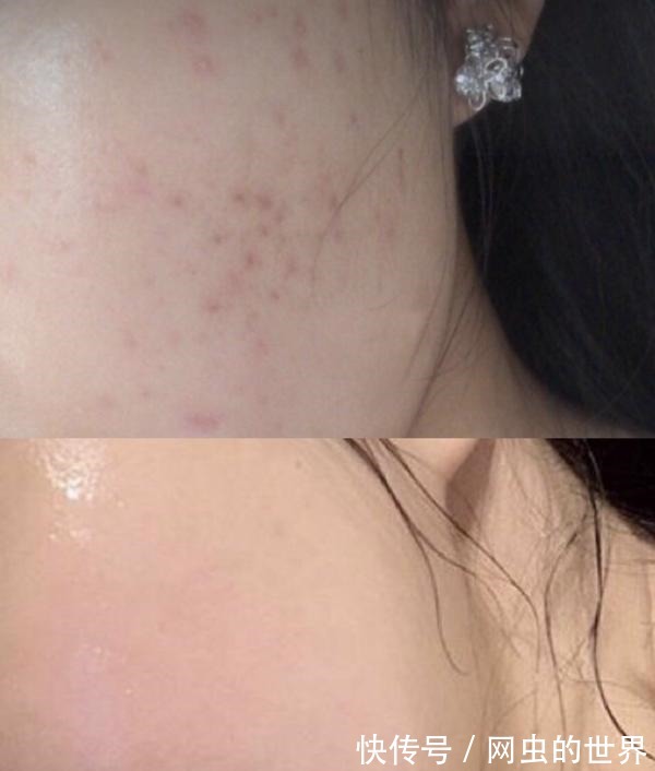 白皙 女人坚持护肤后,皮肤能变多好亲测实验结果,素颜也能白皙细腻!