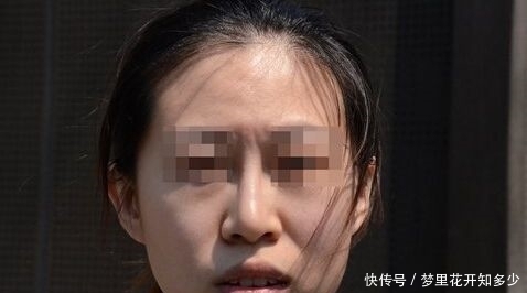 女子整鼻失败,调整三次都失败,工作人员:失败是成功之母