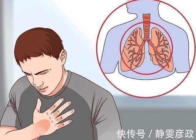 喉返神经|注意肺癌患者出现1信号,预示着癌细胞已扩散