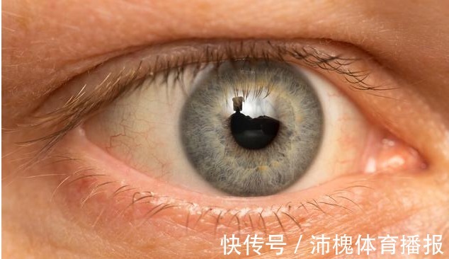 耳垂|血脂高不高，看头就知道，若没有4种症状，恭喜，血管还算通畅