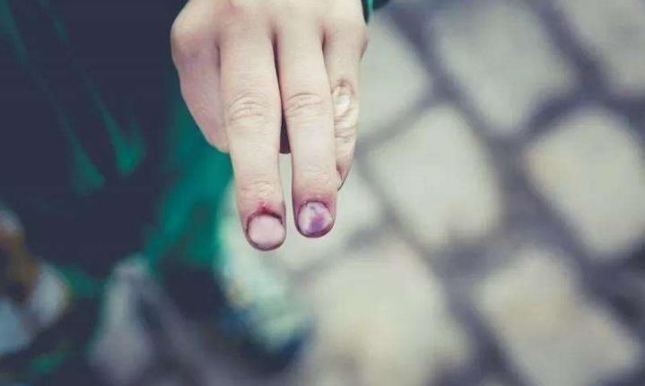 奶奶|3岁小男孩爱啃指甲,妈妈紧急纠正,奶奶:不就吃个手,有啥要紧