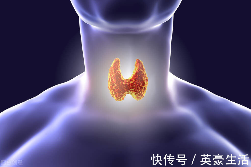 食物|甲状腺结节“祸根”已公布,停止食用这3种食物,结节也许会变小