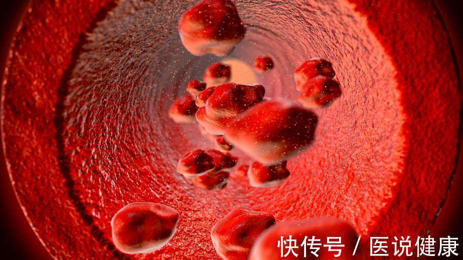 血管|中年后,牢记这6点,或能避免血液粘稠,远离血管疾病