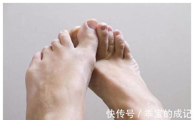 肾脏健康|肾脏出现了问题,脚会有这3个症状!一个没中的话,就恭喜你了!