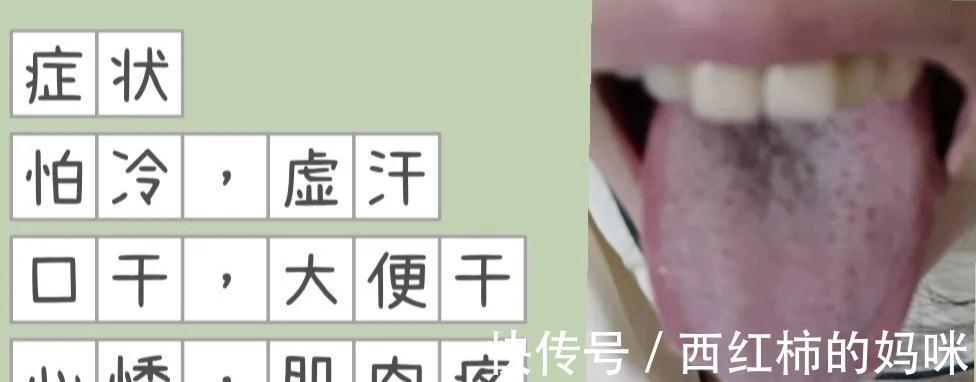 大便|便秘、大便先干后稀、大便溏稀不成型、羊屎便都是怎么回事？