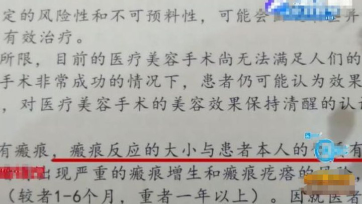 缩胸 女子发育太好影响生活,3年前做了缩胸手术,但现在却后悔不已