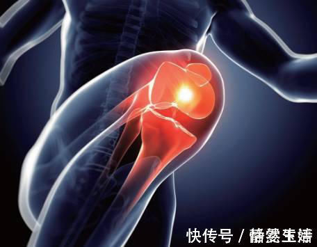 伤害|膝盖有响声是关节炎吗?伤害膝盖的这些习惯,第2个你我都有