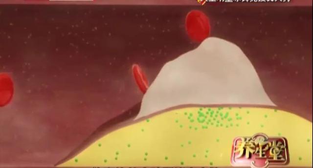 斑块|人猝死前的4个求救信号,收到就是救命,一定要知道