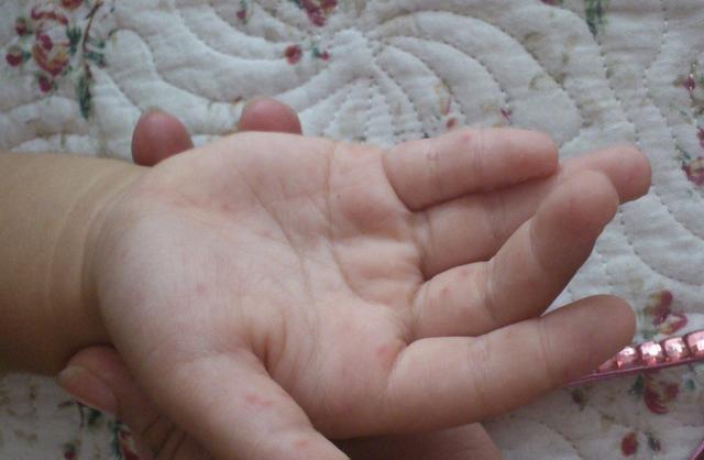 家娃|孩子聪明不聪明,从手上这些特征就能看出,快看看你家娃有吗