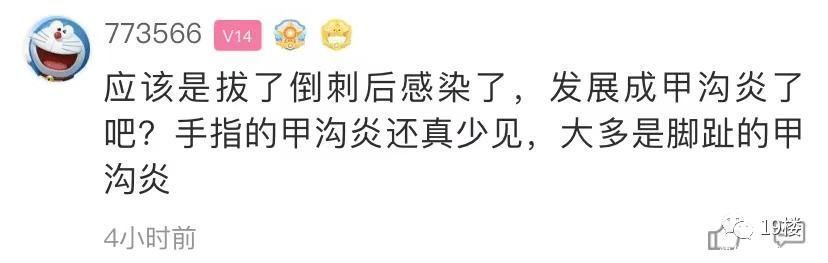 截肢|一个手贱，姑娘整片指甲盖都被拔了…还有人因此截肢！