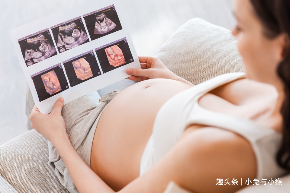 四维彩超套近乎,想得到点“关键信息”,孕妈们产检目的别错了!
