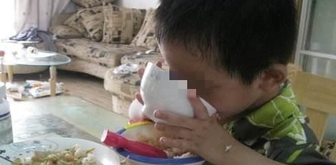 乳牙|6岁男孩长出“双排牙”,要一颗颗拔掉,妈妈自责不已,都怪我