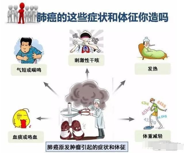  中晚期|为什么肺癌病人早期一般没有症状表现，一旦出现症状，均为中晚期