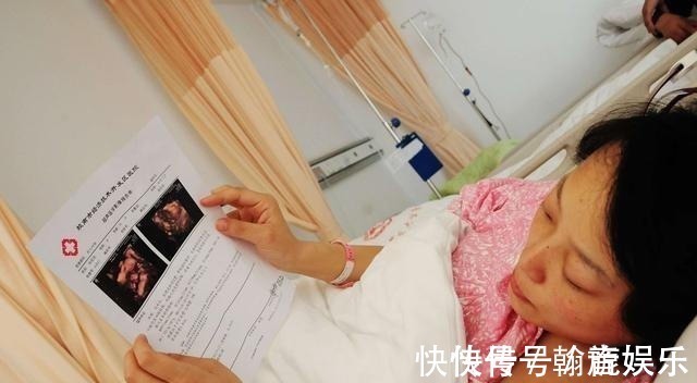 胎儿|孕期要做四维彩超,四维彩超的这些误区和认识,孕妈妈早知道早好