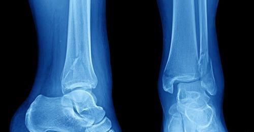 衰老|很多“病”不算病,只是因为年纪大了:这4种疾病,不用过度治疗