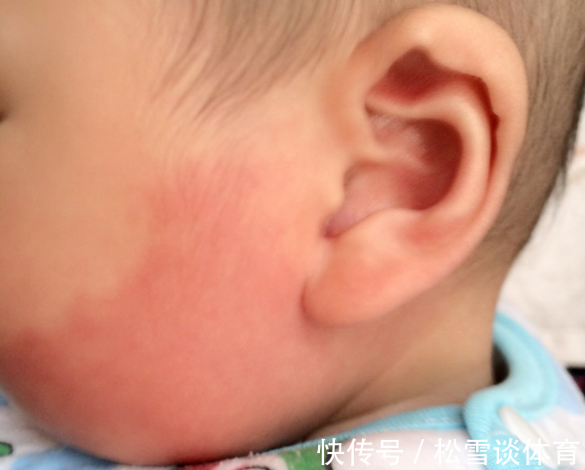 淡青色|孕期别干5件事,不然胎记找上宝宝,不然长大被孩子怨恨