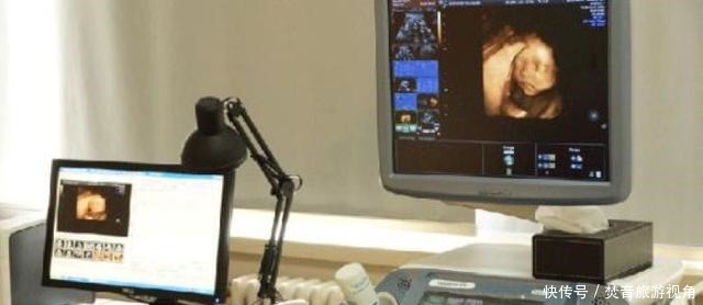 算数|“天才”胎儿走红,还在妈妈肚里就会“算数”,医生清华北大等你