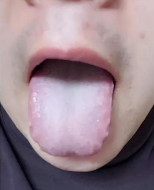 涌泉穴|肾好不好,这三种原因要知道!补肾不盲目,一定要知道3种情况