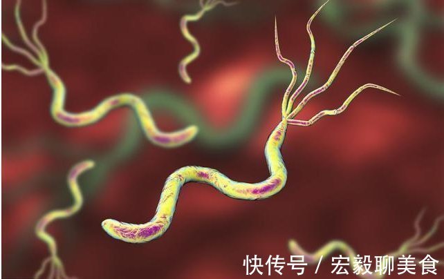 上皮细胞|幽门螺杆菌，中国人胃癌首害！医生提醒：积极预防，要做到这6点
