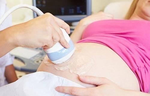 入盆是什么感觉？孕妈多注意这4个情况，提前做足准备到时不慌乱