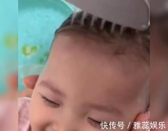 父母|宝宝头发总是“竖着长”可能是营养不足,这3个原因妈妈要分清