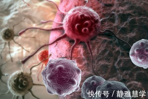 血脂|想要治愈癌症，首先要满足4个条件，可惜挺过去的人不多