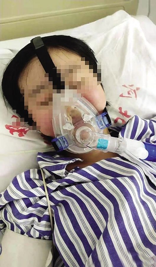 河北省人民医院|女孩遭姐夫投毒百草枯 肺移植需要100万元