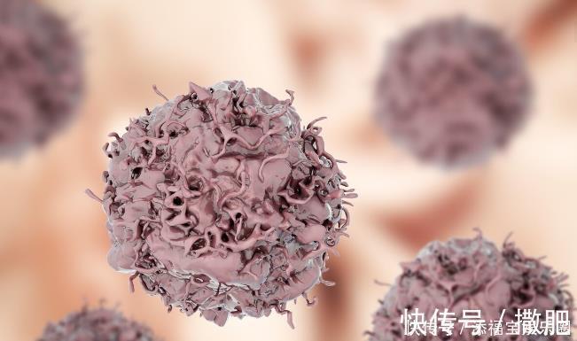 刘医生|五十岁以后更容易长肿瘤?老年人要留意这些症状,出现后及时检查