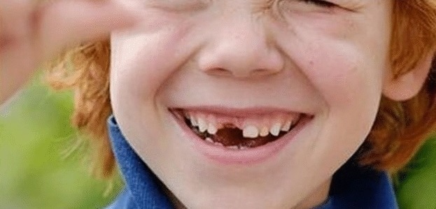 牙齿|如果用牙齿来判断颜值的话,大家觉得问题容易出现在哪里呢?