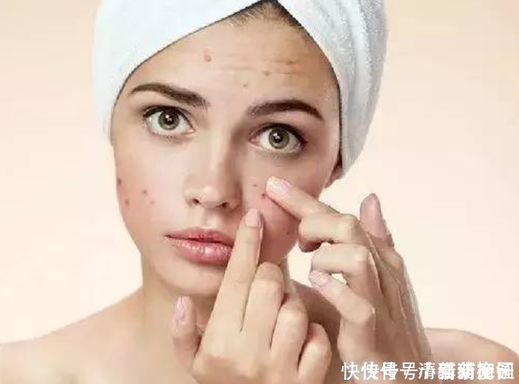 清洁|脸上痘痘反复长很困恼别怕!教你5个方法,帮你快速清除痘痘!