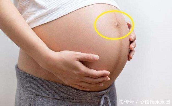 眼儿|女性怀孕后，肚脐眼是凸起是凹进，受3个因素影响，别轻易忽视