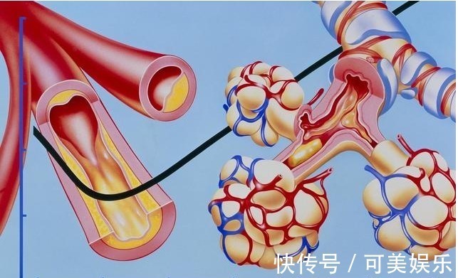 高血脂|98岁中医,血管再堵,用对这个方法,快速解决高血脂,用1个好1个