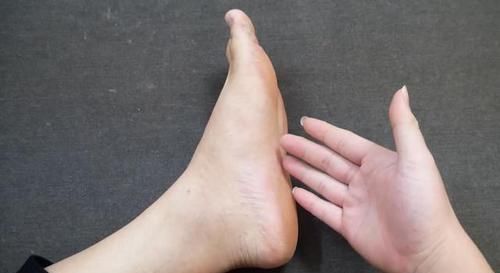 白醋家里有吗倒在脚上搓一搓太厉害了，可惜今天才学会