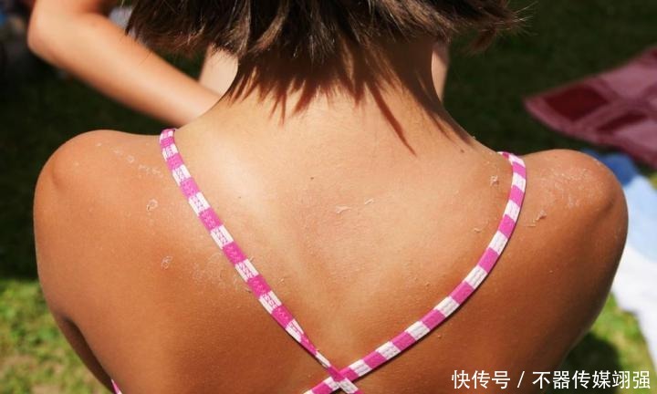 皮肤|暴晒后又黑又丑该如何拯救?|晒后修复指南:美白、抗老一招搞定