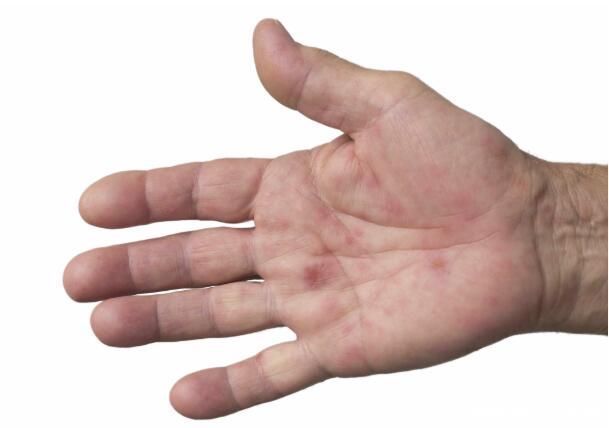 信号|近期手脚突然莫名出现以下几个症状，当心就是癌变已经敲响了信号