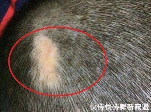 剖腹产|剖腹产划伤孩子头部,医生很快就会好的,7年后家长找上医院