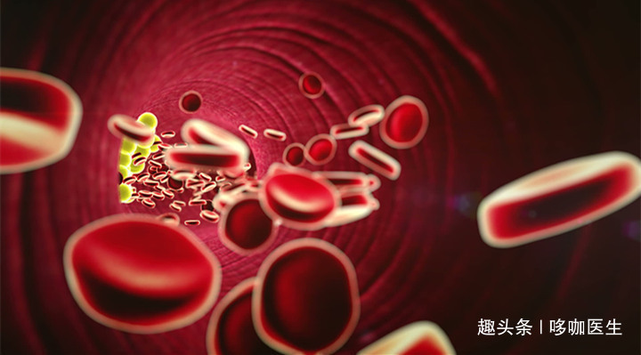 指标|引发心梗的高血脂，应该检查哪些指标