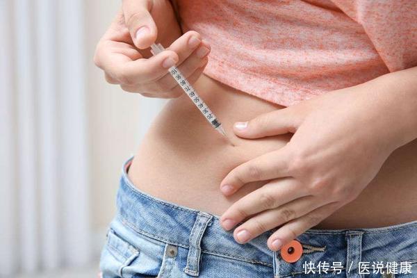 皮肤|皮肤出现这3种“怪象”,不能拖,或是糖尿病的“敲门声”!