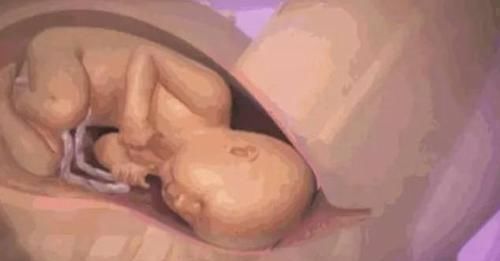准妈妈|那么大的胎儿是怎么从产道出来的三张图让你看完整个过程……