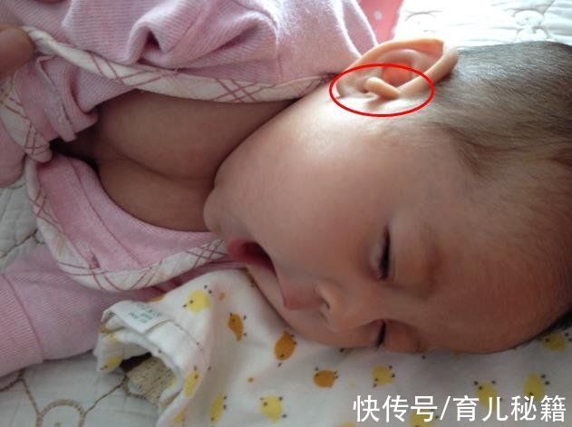 拴马桩|“孩子出生100天，我割掉了她的小耳朵”，拴马桩非福气，别迷信