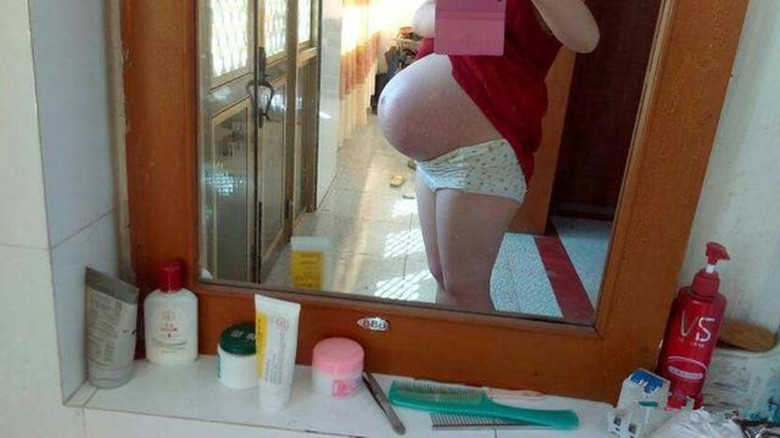 剖宫产史|一胎二胎剖腹产,第三胎怀孕有6个风险