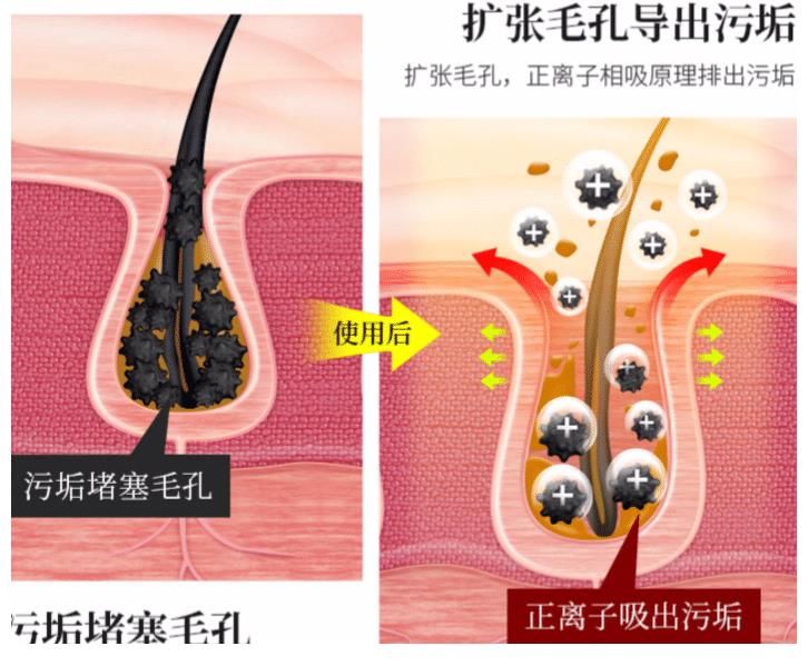 皮肤|为变美做“脂肪填充”的女人，如今变啥样了？过来人：还不如不做