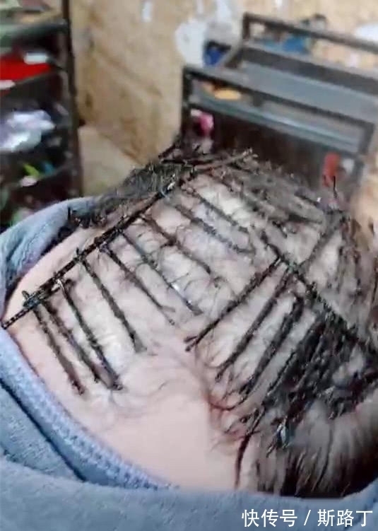 男子|奇闻:男子用黑色发卡烫发,卷起来头发更稀疏,怕剩下头发被扯掉