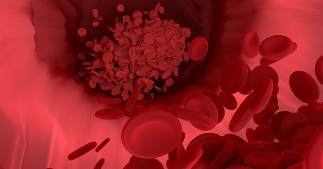 中老年人|多走路可以降低血脂?医生提醒:常吃这4种食物,或比走路效果好