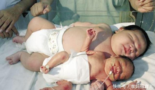 体重|新生宝宝越胖越好?醒醒吧!研究表明:这个体重的宝宝,智商最高