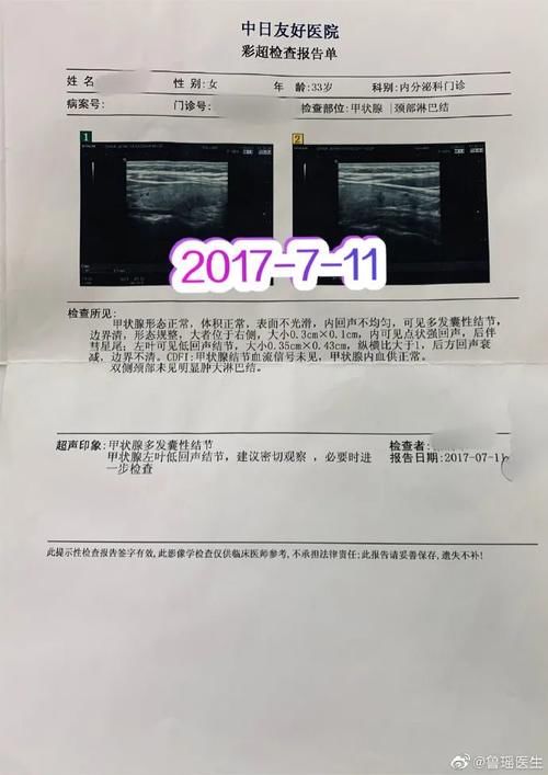 B超怀疑甲状腺结节恶性，甲穿提示为良性，基因检测到有突变，到底是“良性”还是“恶性”？